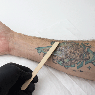 Dynarex Sterile Tongue Depressors — Box of 100